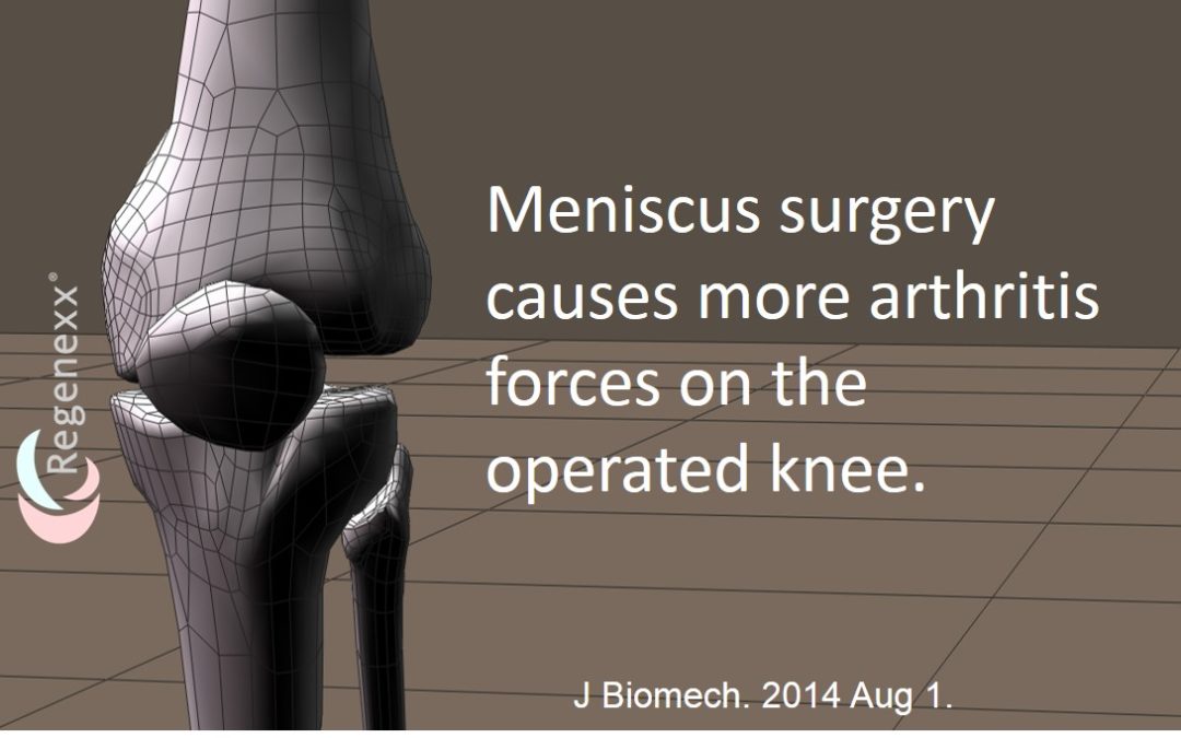Meniscus Surgery Arthritis : Removing a Small Amount of Meniscus Causes Problems