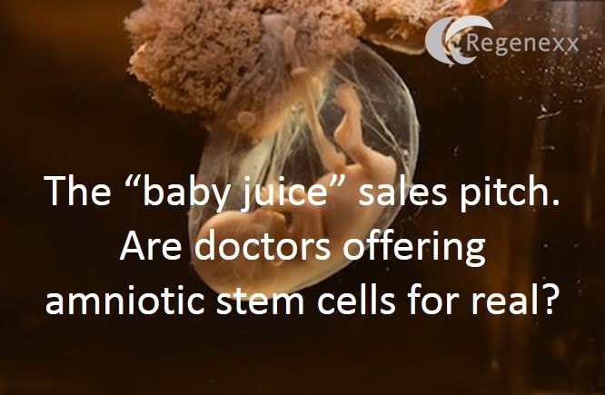 The Baby Juice Sales Pitch: Amniotic Stem Cell Review
