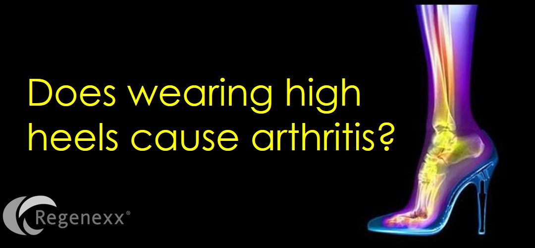 Do High Heels cause Arthritis? New Study Says No…