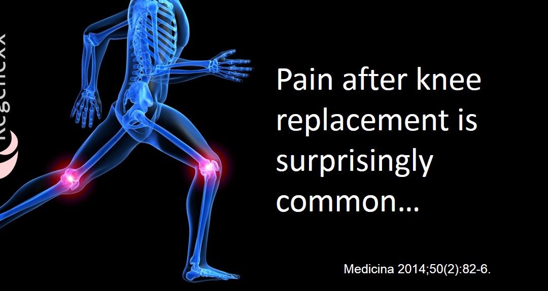 7-ways-to-help-improve-stiffness-and-pain-1-year-after-knee-replacement