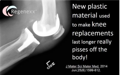 Problems with Knee Replacement? New Plastic Really Pisses Off Body.