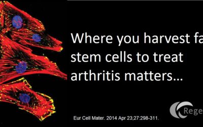 Fat Stem Cell Arthritis Treatments: Are All Fat Stem Cells Equal?