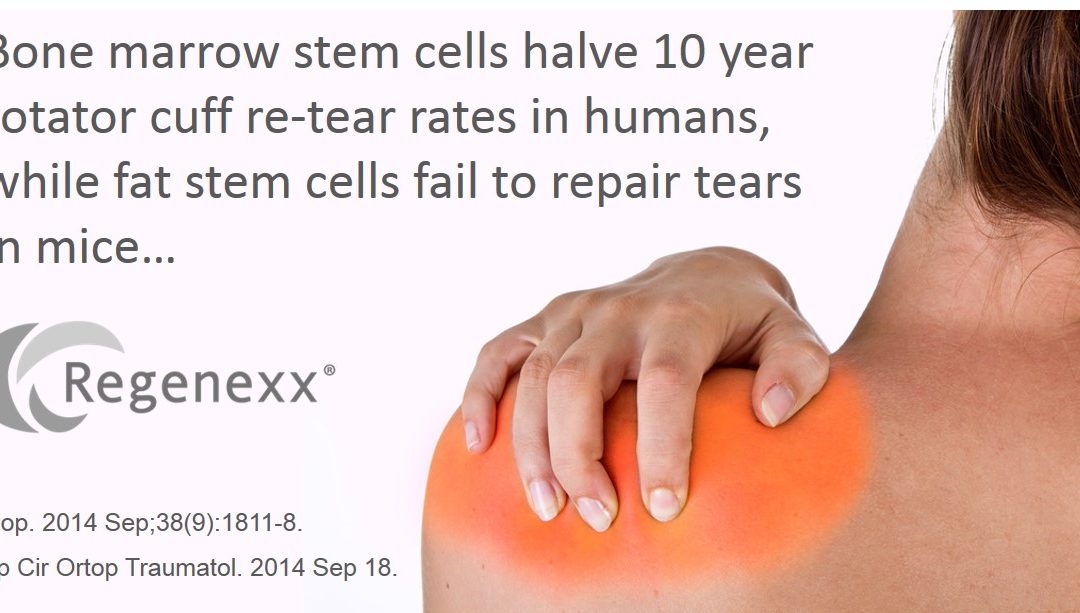 Fat Stem Cells Fail to Help Shoulder Rotator Cuff Injuries Heal
