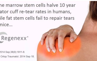 Fat Stem Cells Fail to Help Shoulder Rotator Cuff Injuries Heal