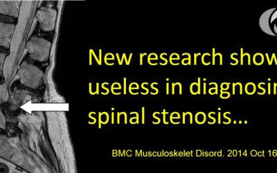 Spinal Stenosis Injections: Never Trust a Back MRI!